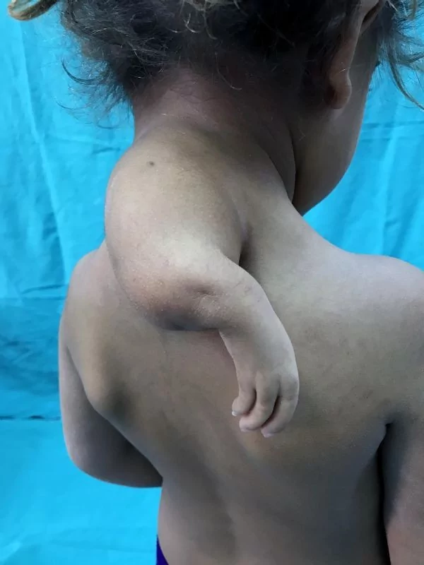 Doktorlar müdahale edemedi, işte son hali!