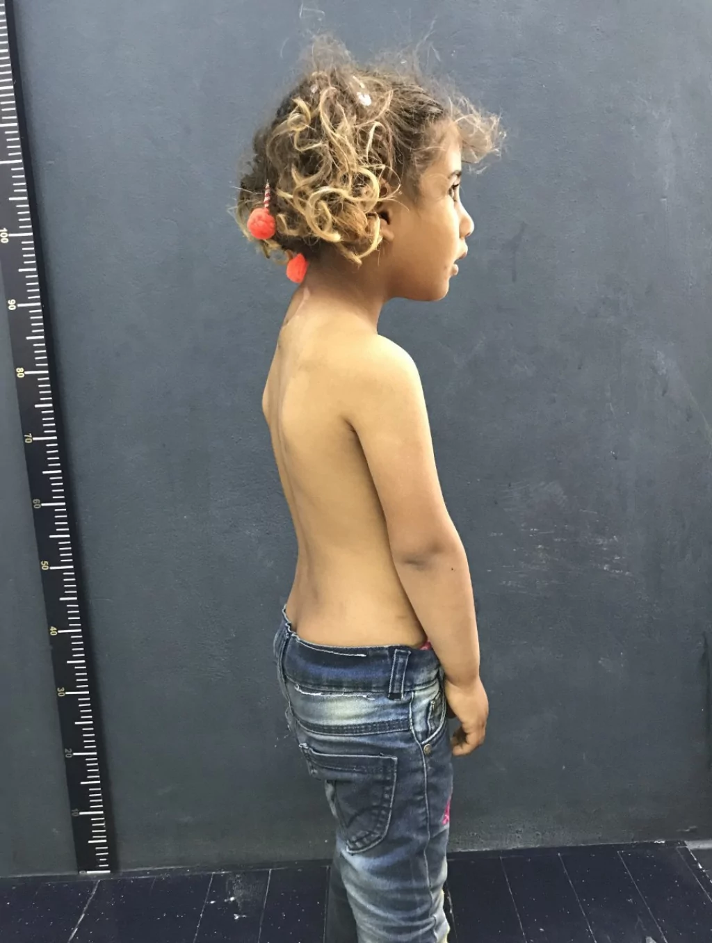 Doktorlar müdahale edemedi, işte son hali!