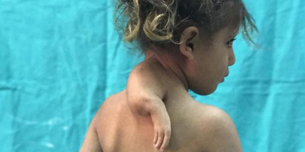 Doktorlar müdahale edemedi, işte son hali!