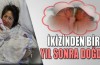 İkizinden 1 yıl sonra doğdu