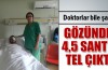 Doktorlar bile şaşırdı