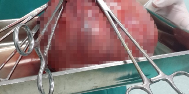 Doktorlar bile şaşkına döndü!