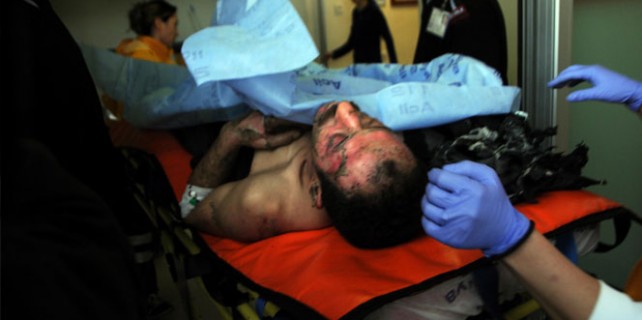 Barışmak istedi, eşi ve çocuğu yaktı