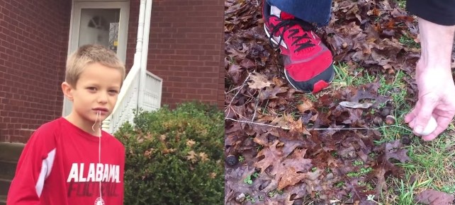 Böyle diş çekme yöntemi görülmedi!