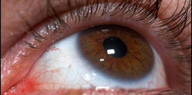 Bu hastalıklar körlüğe neden oluyor