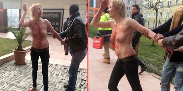 Rezidansta şok! Çıplak Rus kadın kanlar içinde kaldı