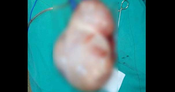 Karnından çıkan şok etti!