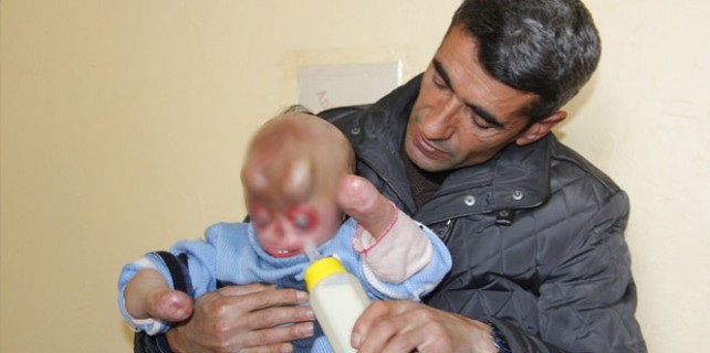 Yüzünü görenlerin yüreği parçalanıyor!