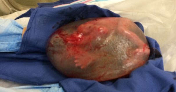 İnanılır gibi değil! Böyle dünya geldi