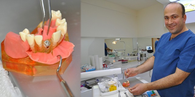 Sahte implantlara dikkat! Merdiven altı yaptırmayın