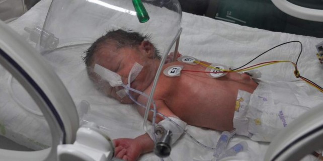 Bursa'da doğan bu bebek tıp dünyasını şaşkına çevirdi