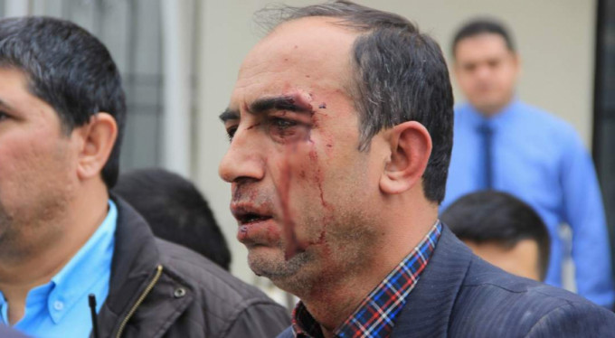 Kantin ihalesinde kan döküldü