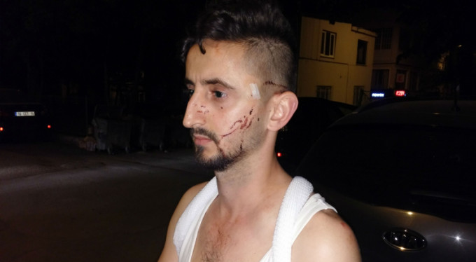 Bursa'da otobüs şoförü genci çekiçle dövdü