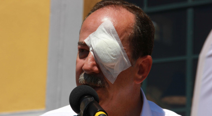 CHP'li başkana saldırı