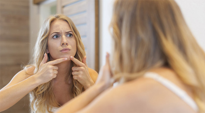 İşte sivilceden kurtulmanın yolu