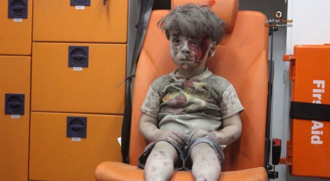 İşte Suriyeli Ümran'ın son görüntüleri