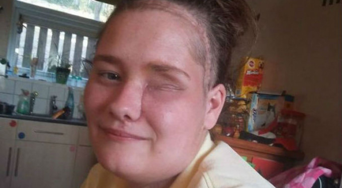 Apse tedavisine gitti gözünden oldu