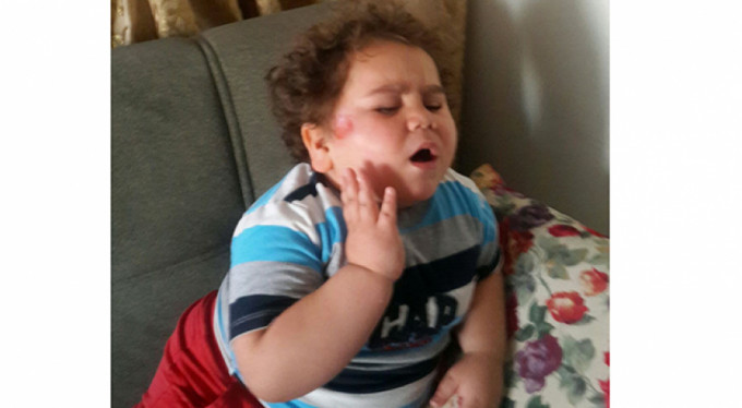 Çitos Efe'ye nazar değdi