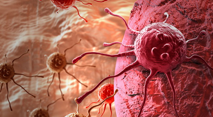 Kanserin sinsi belirtilerine dikkat