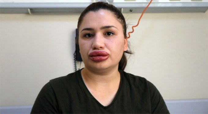 Sahte estetikçi için şok karar!