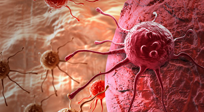 İşte Jinekolojik kanserlere karşı öneriler