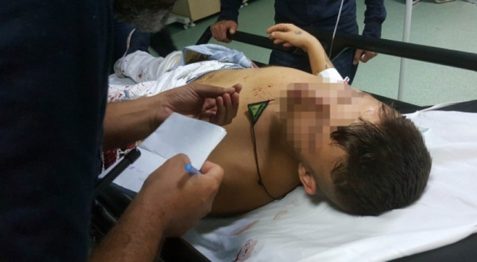 2 senede 2 kez ölümden döndü