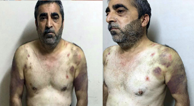 Fidyeciler bu hale getirdiler! Operasyon kamerada