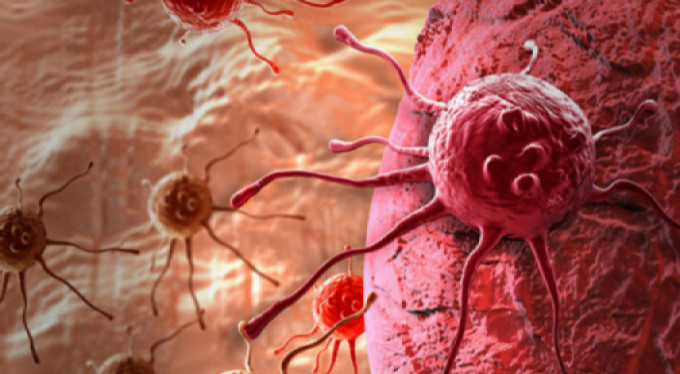 Rahim kanseri menopoz dönemini bekliyor