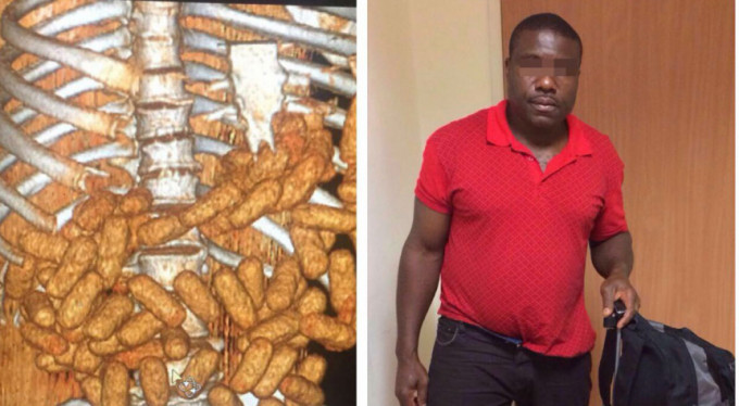 Midesinden çıkanlar herkesi şok etti!