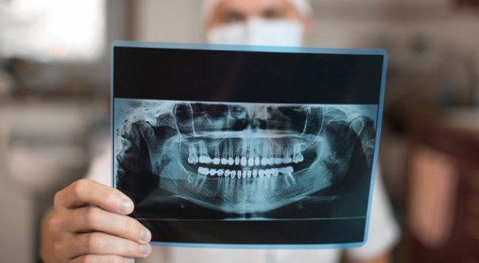 Diş röntgeninde radyasyon riskine karşı önlem şart