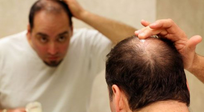 Erken saç dökülmesinden korunmanın yolları