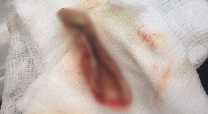 Trafikte inanılmaz olay! Isırarak kopardı