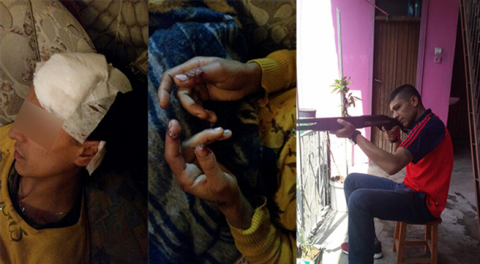 Film gibi hayat hikayesi 'Panik butonu'na bağlı hayat