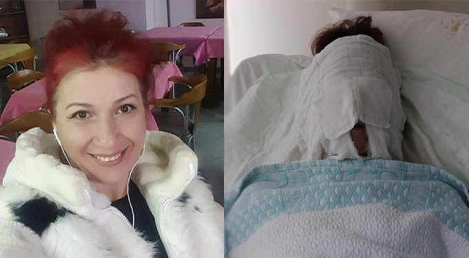 Eski sevgili dehşeti! "Bir daha da yüzümü göremedim"