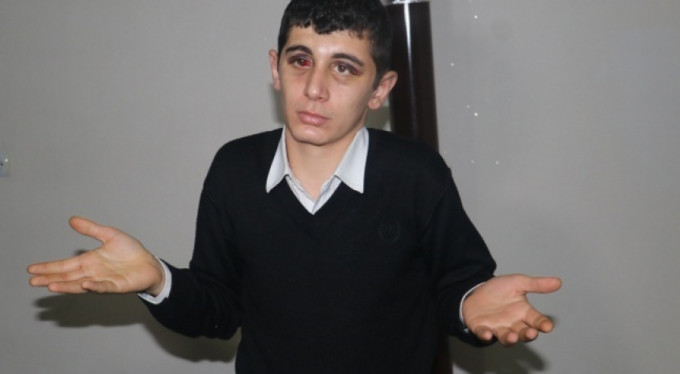 Engelli genci dövenler için 4,5 yıl hapis istendi!