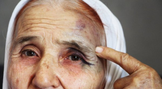 Eski gelinden sokak ortasında dayak!