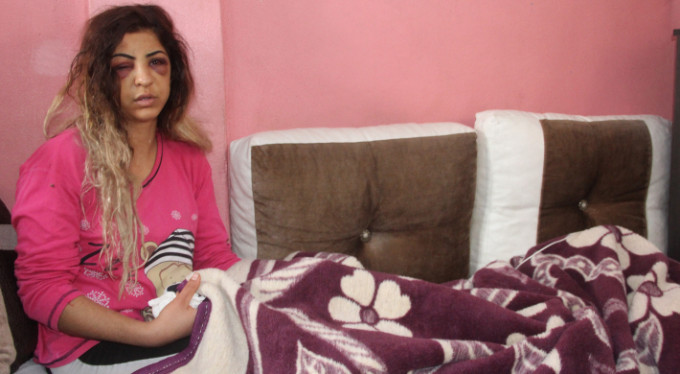 Yine kadına şiddet! Eşini sokak ortasında yarım saat boyunca dövdü!