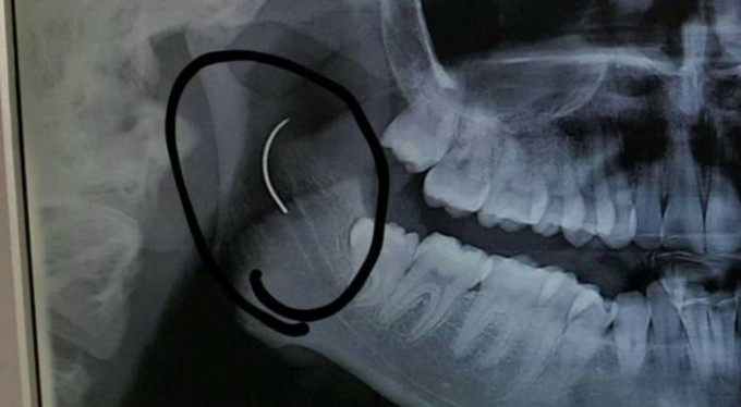 Doktorlar bile inanamadı! 18 yıl böyle yaşadı...