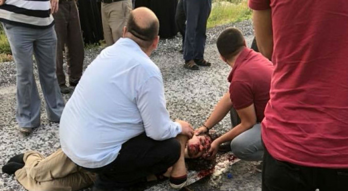 'Kaplumbağa ölmesin' diye mücadele verirken kendisi ölüyordu