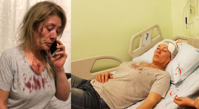 Köpeklerini gezdirirken hayatının şokunu yaşadı!