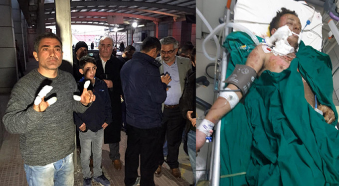 Elektrik akımına kapılan genç Derince Yanık Ünitesi'ne sevk edildi