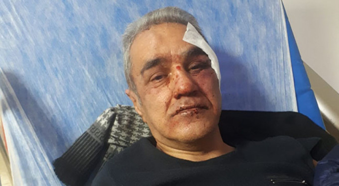 Doktorlara şiddet devam ediyor! Bu hale getirdiler...