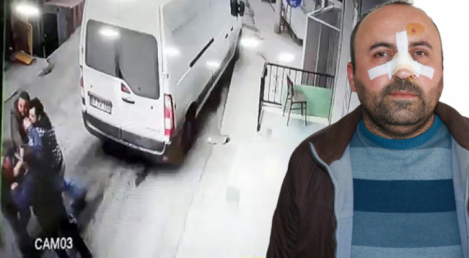 Ekmeği ucuz sattı diye burnunu kırdılar!