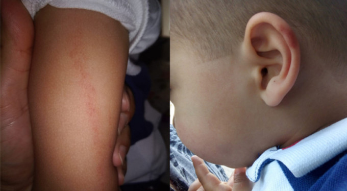 Kreşte korkunç iddia! 3 yaşındaki çocuğa...