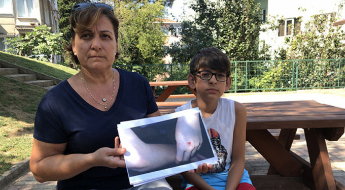 Köpek saldırılarına karşı nöbetteler!