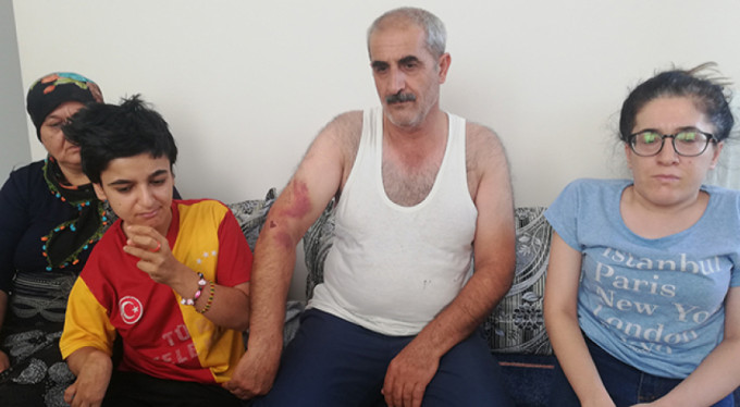 Engelli kız ve babasına 'Bana niye oy vermedin' dayağı!