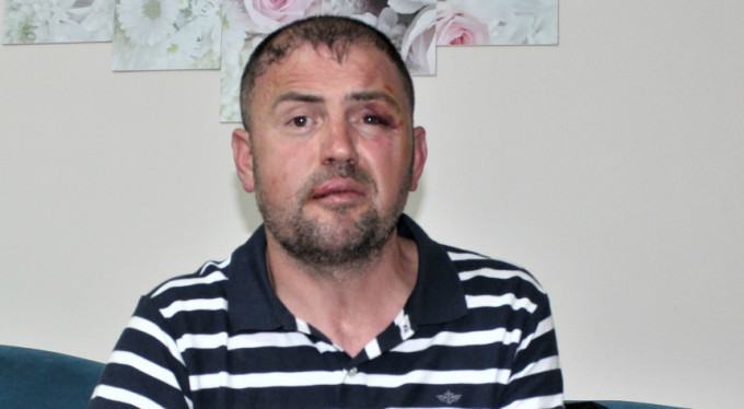 Bursa'da gaziyi darp etmişlerdi! İşte karar...