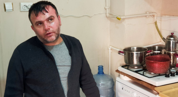 Tavuklu patates hayatına mal oluyordu