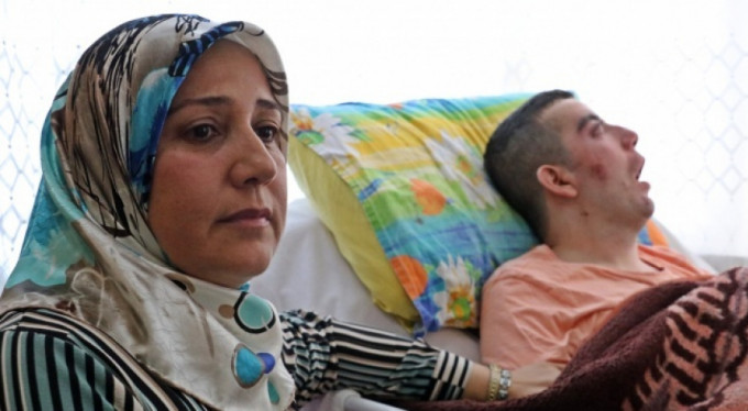 5 yıldır gözlerini kırpamıyor, adeta kan ağlıyor