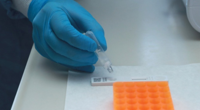Hızlı tanı kitleri Türkiye'de! İşte detaylar...